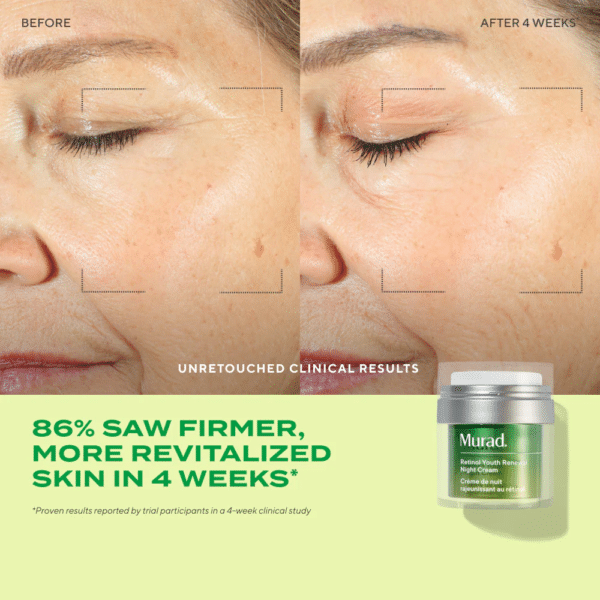 Crema nocturna Murad retinol youth renewal night 50ml - Imagen 3